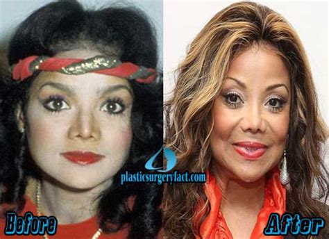 latoya jackson before plastic surgery|LaTOYA JACKSON shows new face after major nose surgery